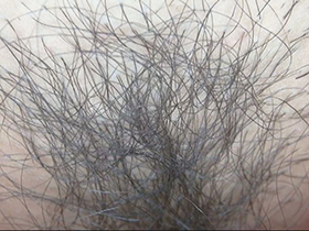 300人のまん毛3　サンプル画像03